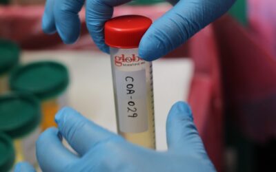COATA: TOMAN MUESTRAS DE ORINA A POBLACIÓN DE LA CUENCA COATA, A FIN DE DETERMINAR LA PRESENCIA DE METALES PESADOS EN LA SANGRE