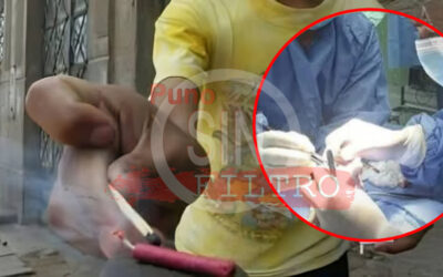 Niño perdió Nueve Dedos y Sufre Graves Lesiones Oculares tras Explosión de Pirotécnico