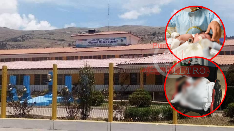 BEBÉ NACIÓ EN UNO DE LOS BAÑOS DEL HOSPITAL DE PUNO. DIRECTOR DEL NOSOCOMIO TRATÓ DE MINIMIZAR NEGLIGENCIA