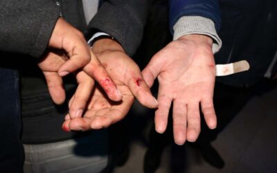 AZANGARO| RAYO MATÓ A MADRE E HIJA EN AZANGARO