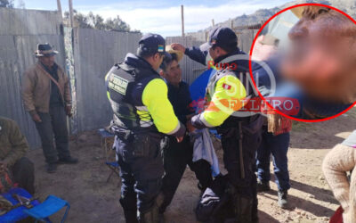 HOMBRE RESULTÓ CON QUEMADURAS EN ROSTRO Y CUELLO, DURANTE LA FIESTA DE SAN PEDRO Y SAN PABLO EN ICHU