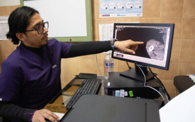 JOVEN MADRE SUPERA CÁNCER DE PIEL Y EVITA AMPUTACIÓN TRAS EXITOSA CIRUGÍA EN HOSPITAL DE ESSALUD