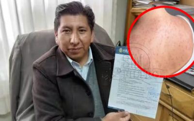 POR BROTE DEL SARAMPIÓN, SAN ROMÁN DECLARA PRIORIDAD SANITARIA POR 90 DIAS